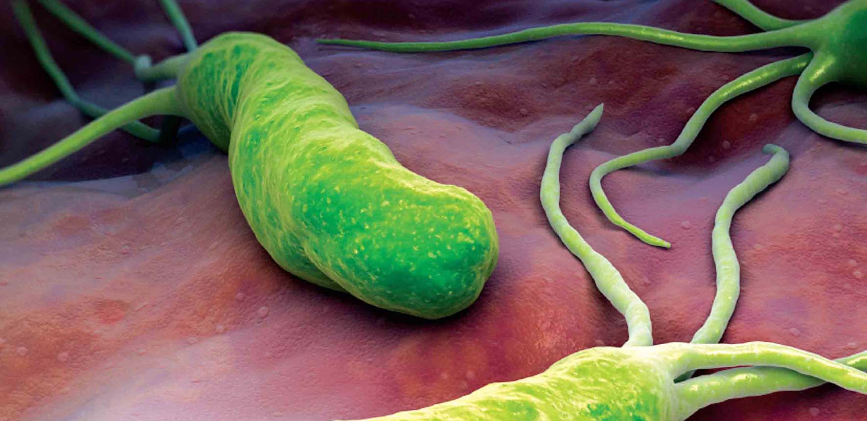 ulcera helicobacter pylori cura