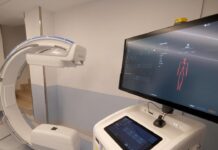 Nuovo scanner 3D per aorta e vasi sanguigni all’Irccs Negrar, il primo in Italia scanner 3D